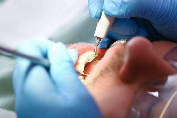 Best Broken Tooth Emergency  in Georgetown, CT